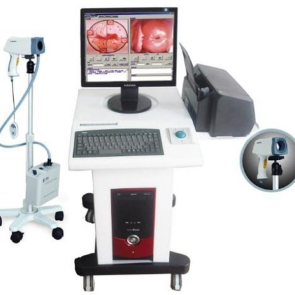 Máy soi cổ tử cung KN 2200